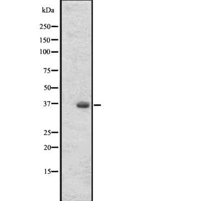OR2T27 Antibody