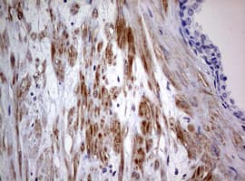 AFAP1 / AFAP Antibody (aa100-386, clone OTI2G9)