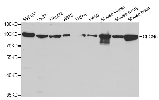 Polyclonal Rabbit anti-Human ClC-5 / CLCN5 Antibody (IHC, IF, WB)