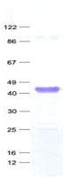 Human MAGEA3 Protein (Recombinant His, N-Terminal)