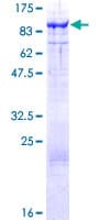 Human HT2A / TRIM32 Protein (Recombinant GST)