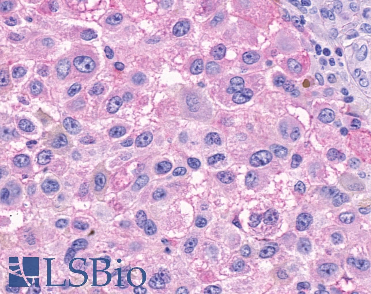 PathPlus™ Polyclonal Rabbit anti-Human GPR150 Antibody (N-Terminus, IHC)