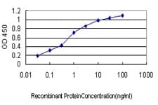 TTN / Titin Antibody (clone 2B3)