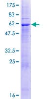 Human ZPBP2 Protein (Recombinant GST)