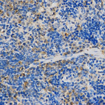Polyclonal Rabbit anti-Human STXBP1 / MUNC18-1 Antibody (IHC, WB)