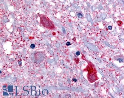 PathPlus™ GPR32 Antibody (Extracellular Domain)