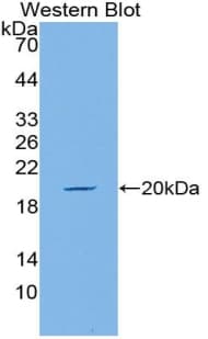 MUC5AC Antibody (aa4944-5030)