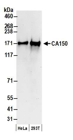 IHC-plus™ Polyclonal Rabbit anti-Human TCERG1 / CA150 Antibody (aa1-50, IHC, WB)