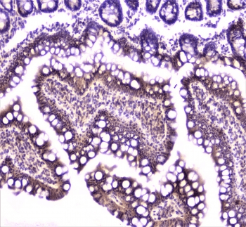 TANK Antibody