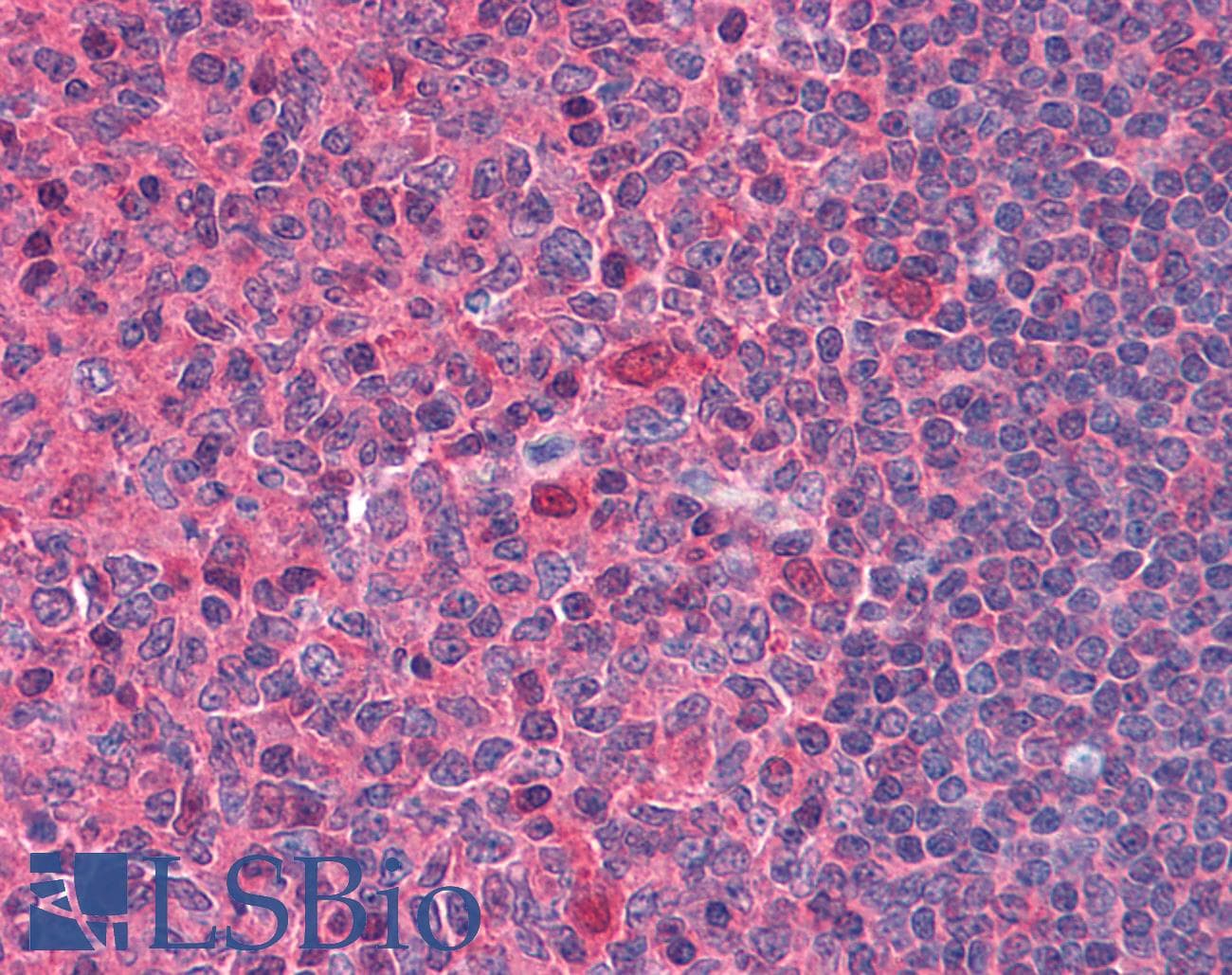 IHC-plus™ DNASE1 / DNase I Antibody