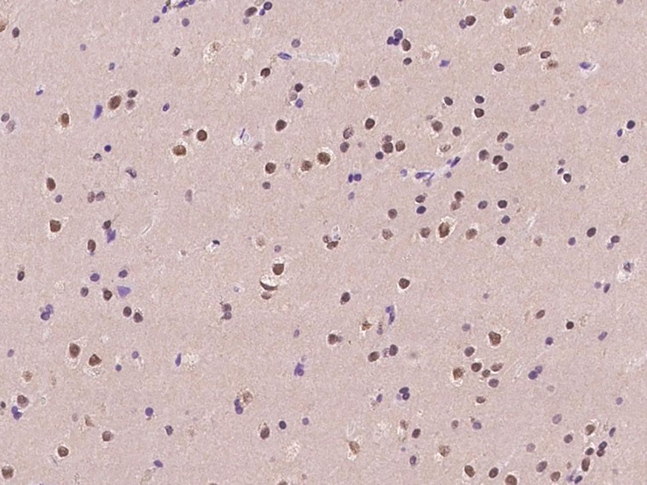 Polyclonal Rabbit anti-Human C11orf46 Antibody (IHC)