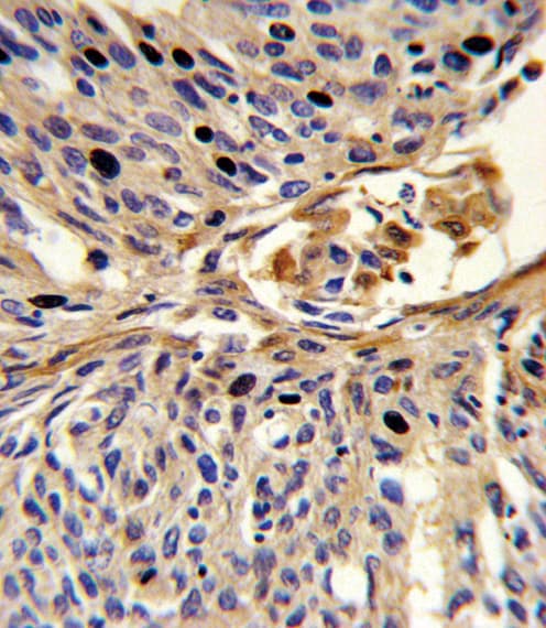 Polyclonal Rabbit anti-Human APEX2 Antibody (aa143-171, IHC, IF, WB)