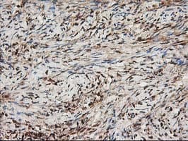 NUDEL / NDEL1 Antibody (clone OTI5E11)