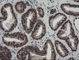 Monoclonal Mouse anti-Human TPRKB Antibody (clone OTI1E9, IHC, WB)