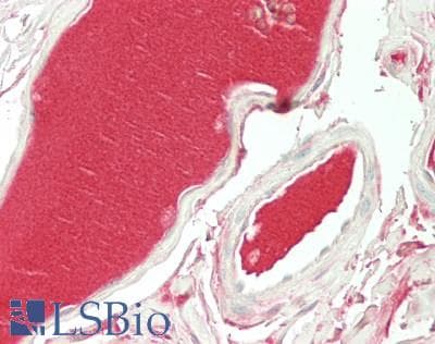 Polyclonal Rabbit anti-Human F12 / Factor XII Antibody (N-Terminus, IHC, WB)