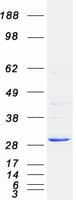 Human PNMT Protein (Recombinant Myc-DDK (Flag))