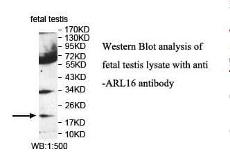 Polyclonal Rabbit anti-Human ARL16 Antibody (aa19-197, IHC, WB)