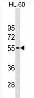 CDKN1C / p57 Kip2 Antibody (aa34-64)