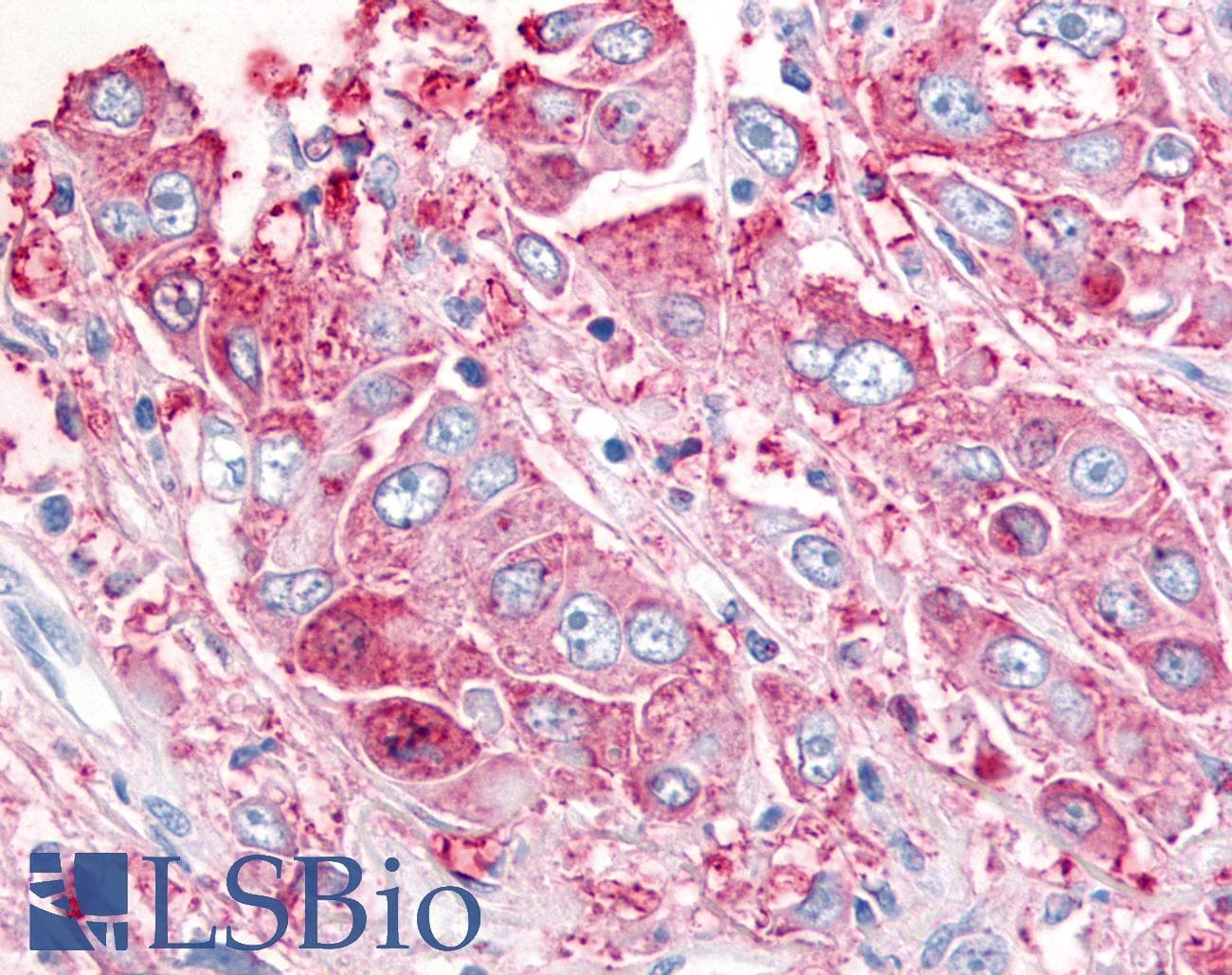 PathPlus™ USP20 / VDU2 Antibody (Internal)