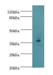 Polyclonal Rabbit anti-Human EFNB2 / Ephrin B2 Antibody (aa28-229, IHC, WB)