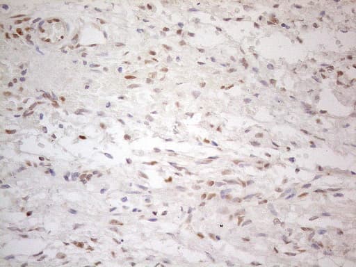 ER Alpha / Estrogen Receptor Antibody (aa1-310, clone OTI9E6, Carrier-free)