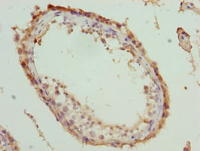 MOV10 Antibody