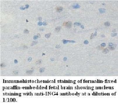 Polyclonal Rabbit anti-Human ING4 Antibody (aa33-183, IHC, WB)