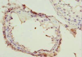 NSFL1C Antibody