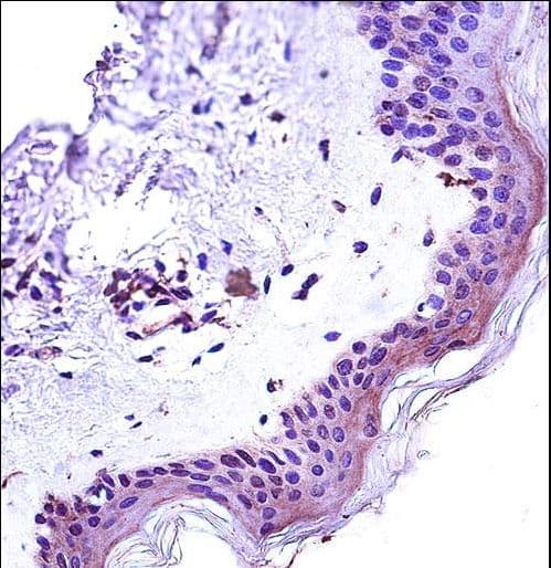 STAT2 Antibody (aa186-215)