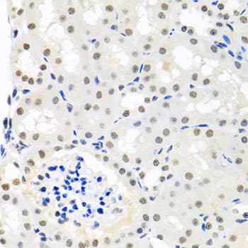 p84 / THOC1 Antibody