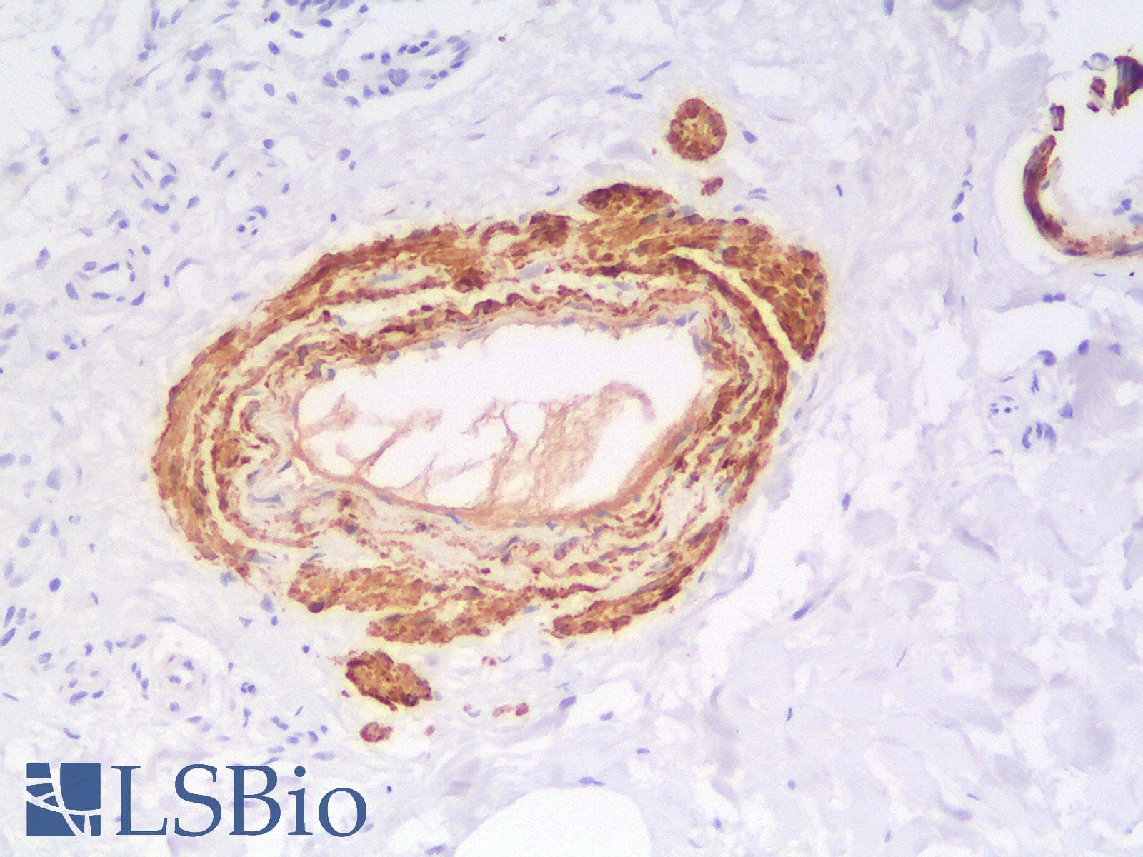 IHC-plus™ Recombinant Monoclonal Rabbit anti-Human CALD1 / Caldesmon Antibody (clone CALD1/1424R, IHC)
