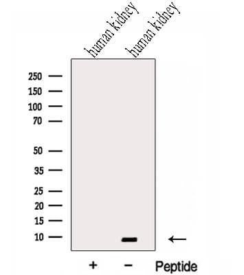 GTF2H5 Antibody