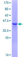 Human PHYKPL / AGXT2L2 Protein (Recombinant GST)