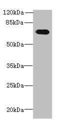 Polyclonal Rabbit anti-Human GBP5 Antibody (IHC, WB)