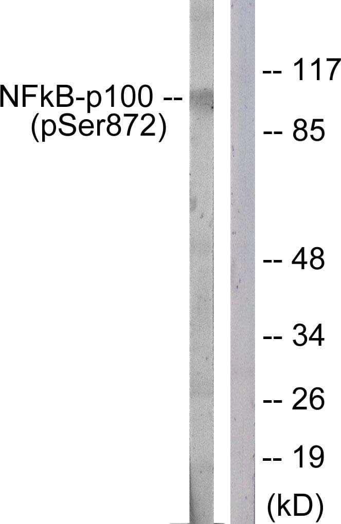 NFKB2 Antibody (phospho-Ser872)