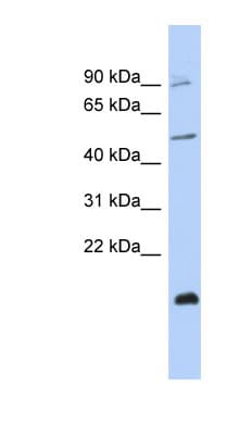 Polyclonal Rabbit anti-Human ZNF645 Antibody (C-Terminus, WB)