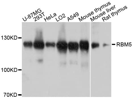 RBM5 / G15 Antibody