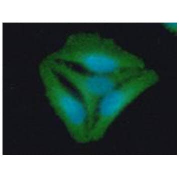 Monoclonal Mouse anti-Human STOM / Stomatin Antibody (clone AT33F5, WB)