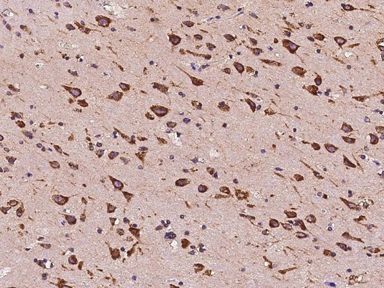 Polyclonal Rabbit anti-Mouse HSPA5 / GRP78 / BiP Antibody (IHC, WB)