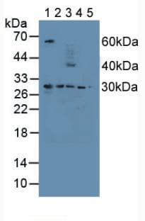 PSMD9 / 26S Proteasome Antibody (aa2-223, Biotin)