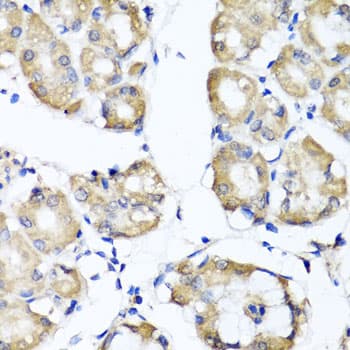 Polyclonal Rabbit anti-Human RBP2 / CRBPII Antibody (IHC, IF, WB)