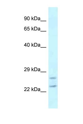 RAB2A / RAB2 Antibody (aa118-167)