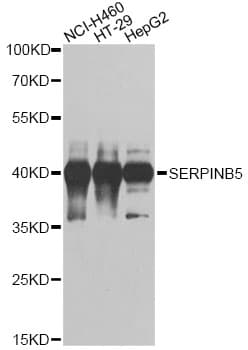 Polyclonal Rabbit anti-Human SERPINB5 / Maspin Antibody (IHC, WB)