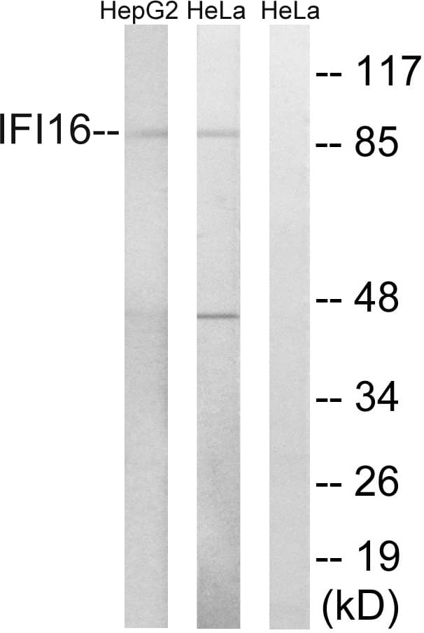 IFI16 Antibody (aa731-780)