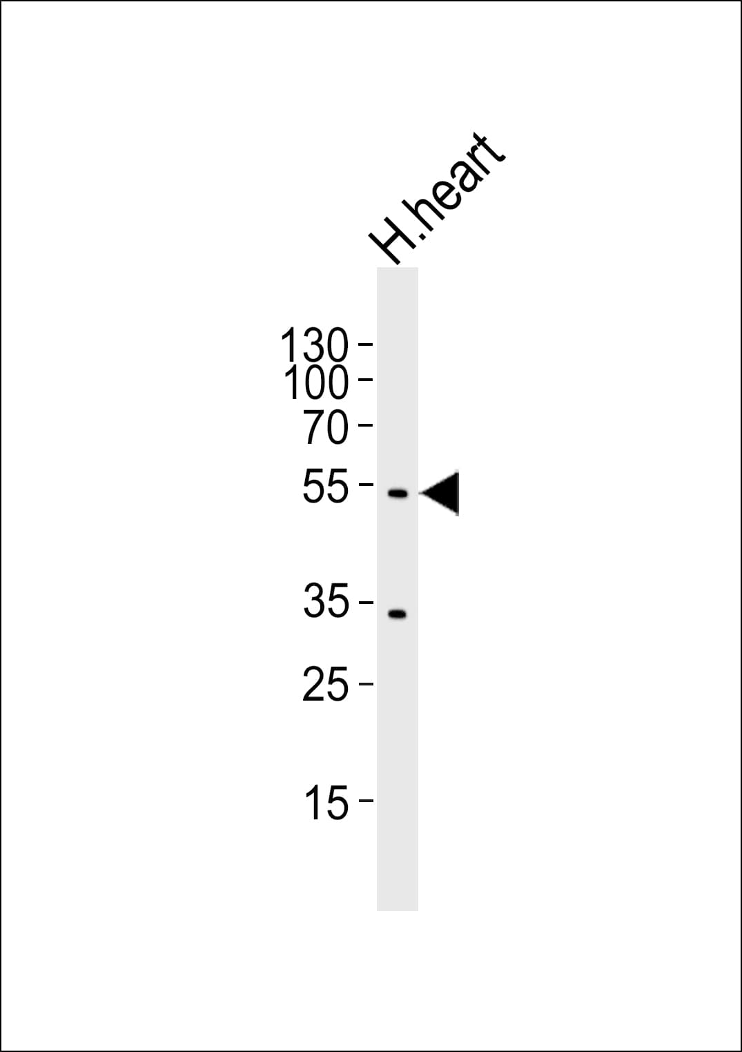 Polyclonal Rabbit anti-Human SLC2A4 / GLUT-4 Antibody (aa495-529, WB)
