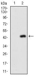 Monoclonal Mouse anti-Human NAPSA / NAPA / Napsin A Antibody (clone 10C4B8, aa20-158, IHC, WB)