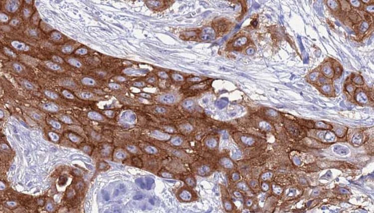 ABCC5 / MRP5 Antibody