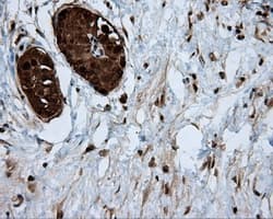 Monoclonal Mouse anti-Human ACLY / ATP Citrate Lyase Antibody (clone 3G8, Carrier-free, IHC, IF, WB)
