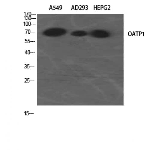 Polyclonal Rabbit anti-Human SLCO1A2 / OATP Antibody (220-300 aa, Internal, IHC, WB)