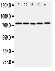 Polyclonal Rabbit anti-Human ABCG1 Antibody (aa627-647, WB)